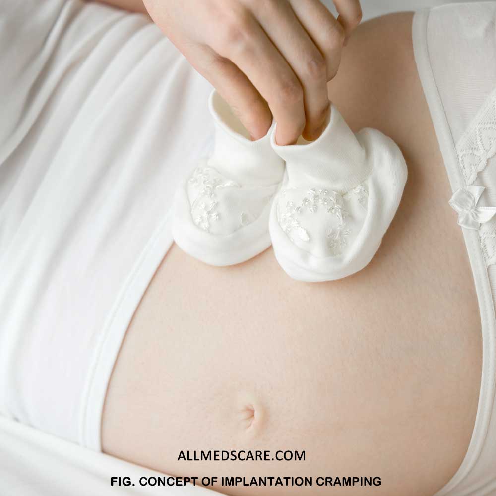 Implantation cramping- Occurrence, Causes & Other Details!